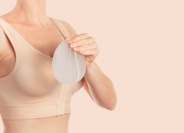 Patientin mit Kompressions-BH nach Brustvergrößerung mit Implantaten
